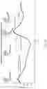 Fig. 22 - Computer-controlled ankle-foot prosthesis with series J-spring actuation