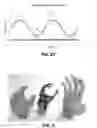 Fig. 07 - HIGH DENSITY DISTANCE SENSOR ARRAY ALTERNATIVE TO SURFACE ELECTROMYOGRAPHY FOR THE CONTROL OF POWERED UPPER LIMB PROSTHESES