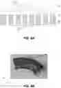 Fig. 08 - HIGH DENSITY DISTANCE SENSOR ARRAY ALTERNATIVE TO SURFACE ELECTROMYOGRAPHY FOR THE CONTROL OF POWERED UPPER LIMB PROSTHESES