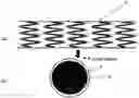 Fig. 01 - Drug-eluting stent including crystalline cilostazol