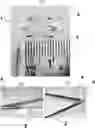 Fig. 01 - SUPER ELASTIC, BIOABSORBABLE ENDOVASCULAR DEVICES