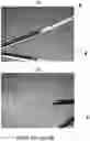 Fig. 07 - SUPER ELASTIC, BIOABSORBABLE ENDOVASCULAR DEVICES