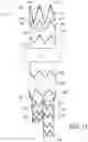 Fig. 12 - AORTIC PROSTHESIS DELIVERY SYSTEM AND METHOD OF USE