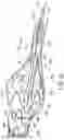Fig. 30 - AORTIC PROSTHESIS DELIVERY SYSTEM AND METHOD OF USE