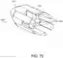 Fig. 59 - AORTIC PROSTHESIS DELIVERY SYSTEM AND METHOD OF USE