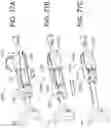 Fig. 65 - AORTIC PROSTHESIS DELIVERY SYSTEM AND METHOD OF USE