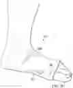 Fig. 04 - Toe walking prevention article
