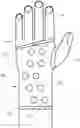Fig. 01 - Conforming rigid cast, brace and splint comprising a curable polymeric material