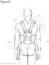 Fig. 07 - Conforming rigid cast, brace and splint comprising a curable polymeric material