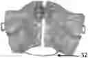 Fig. 01 - ORTHODONTIC/ORTHOPAEDIC DEVICE AND METHOD