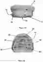 Fig. 02 - ORTHODONTIC/ORTHOPAEDIC DEVICE AND METHOD