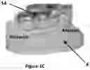 Fig. 03 - ORTHODONTIC/ORTHOPAEDIC DEVICE AND METHOD