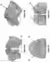 Fig. 04 - ORTHODONTIC/ORTHOPAEDIC DEVICE AND METHOD