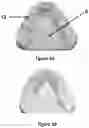 Fig. 06 - ORTHODONTIC/ORTHOPAEDIC DEVICE AND METHOD