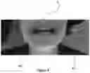 Fig. 07 - ORTHODONTIC/ORTHOPAEDIC DEVICE AND METHOD