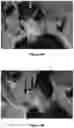 Fig. 09 - ORTHODONTIC/ORTHOPAEDIC DEVICE AND METHOD