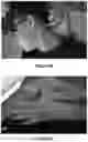Fig. 10 - ORTHODONTIC/ORTHOPAEDIC DEVICE AND METHOD