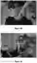 Fig. 11 - ORTHODONTIC/ORTHOPAEDIC DEVICE AND METHOD