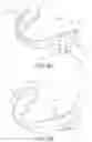 Fig. 03 - Mandibular advancement device