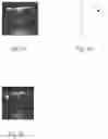 Fig. 03 - ULTRASONICALLY DETECTABLE INTRAUTERINE SYSTEM AND METHOD FOR ENHANCING ULTRASOUND DETECTION
