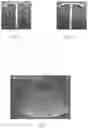 Fig. 06 - ULTRASONICALLY DETECTABLE INTRAUTERINE SYSTEM AND METHOD FOR ENHANCING ULTRASOUND DETECTION