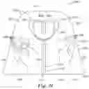 Fig. 13 - GARMENT WITH A CONFIGURABLE CONVECTIVE DEVICE