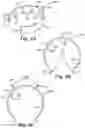 Fig. 18 - GARMENT WITH A CONFIGURABLE CONVECTIVE DEVICE