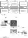 Fig. 10 - Devices and methods for laser surgery of an eye, especially for keratoplasty