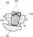 Fig. 01 - Baby Blowout Stopper