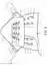 Fig. 10 - Quick release, back carry, first aid kit