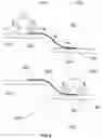 Fig. 07 - Z-shape sliding board utilizing gravity-assistance for patient lateral transfer