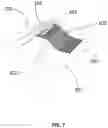 Fig. 08 - Z-shape sliding board utilizing gravity-assistance for patient lateral transfer