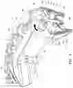 Fig. 05 - Sexual stimulation device