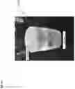 Fig. 20 - Smart cap