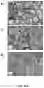 Fig. 06 - PARTICULATE AMORPHOUS MESOPOROUS MAGNESIUM CARBONATE MATERIAL