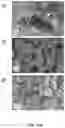 Fig. 07 - PARTICULATE AMORPHOUS MESOPOROUS MAGNESIUM CARBONATE MATERIAL