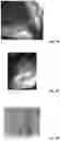 Fig. 33 - EXPANDABLE GASTRORETENTIVE DOSAGE FORM