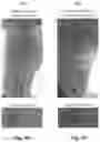Fig. 35 - EXPANDABLE GASTRORETENTIVE DOSAGE FORM