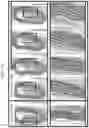 Fig. 03 - RAPIDLY IMPROVING ENDOTHELIAL FUNCTION, REDUCING ARTERIAL STIFFNESS AND REVERSING CALCIFICATION OF BLOOD VESSELS BY ADMINISTERING VITAMIN K