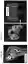 Fig. 11 - RAPIDLY IMPROVING ENDOTHELIAL FUNCTION, REDUCING ARTERIAL STIFFNESS AND REVERSING CALCIFICATION OF BLOOD VESSELS BY ADMINISTERING VITAMIN K