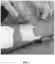 Fig. 02 - SOLID-FORMING TOPICAL FORMULATIONS FOR PAIN CONTROL