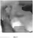 Fig. 03 - SOLID-FORMING TOPICAL FORMULATIONS FOR PAIN CONTROL