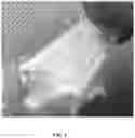 Fig. 04 - SOLID-FORMING TOPICAL FORMULATIONS FOR PAIN CONTROL