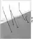 Fig. 20 - COMPOUNDS AND METHODS FOR TREATING ABERRANT ADRENOCORTICAL CELL DISORDERS