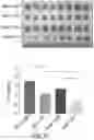 Fig. 18 - Modulation of molecular markers using S-equol