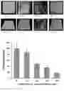 Fig. 15 - MICROORGANISM MIXTURES, MOLECULES DERIVED THEREFROM, AND METHODS OF USE THEREOF