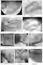 Fig. 23 - MICROORGANISM MIXTURES, MOLECULES DERIVED THEREFROM, AND METHODS OF USE THEREOF