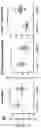 Fig. 04 - USE OF SK2 INHIBITORS IN COMBINATION WITH IMMUNE CHECKPOINT BLOCKADE THERAPY FOR THE TREATMENT OF CANCER