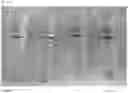 Fig. 10 - METHODS OF TREATMENT AND PHARMACEUTICAL COMPOSITIONS USING BCN057 OR BCN512