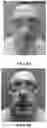 Fig. 03 - Methods and Compositions for Reducing Side Effects in Chemotherapeutic Treatments